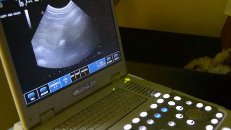 A Little About Ultrasound