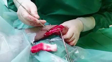 Surgical Repair of a Dog's Broken Leg